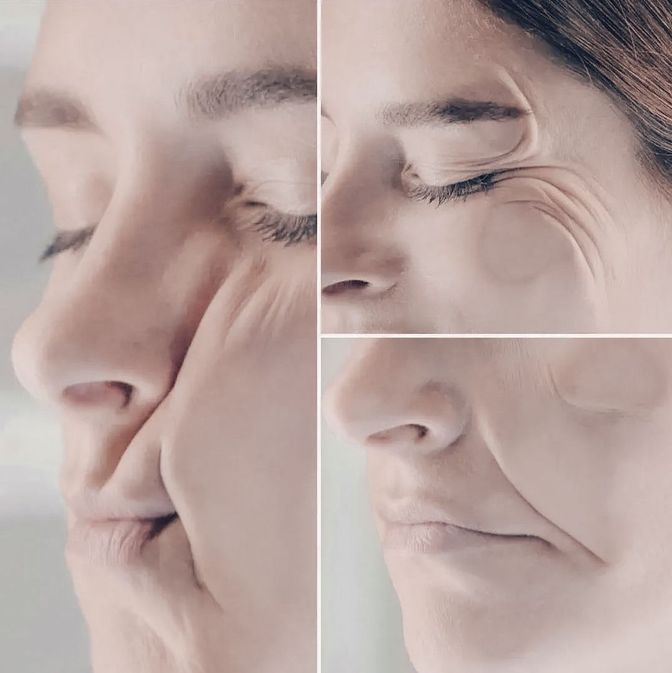Сонные морщины: 4 способа предупредить появление глубоких линий на коже