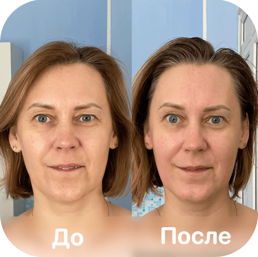 CentrVolkova-kosmeticheskaya-chistka-litsa-do-posle